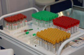 Жителе отдалённых районов Тульской области продиагностируют на наличие онкозаболеваний