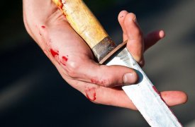 Мужчина, доставленный в больницу Богородицка с ножевой раной живота, скончался