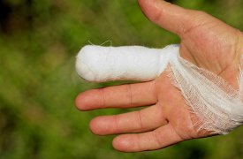 Житель Узловой выложит 30 тыс. руб. за укус полицейского за палец