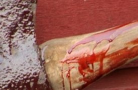 Рецидивист из Тулы зарубил топором знакомого