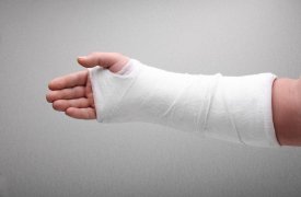 Житель Тульской области сломал руку собственной сестре