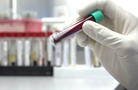 Росздравнадзор провел проверку по факту гибели 10-летнего мальчика от пневмонии