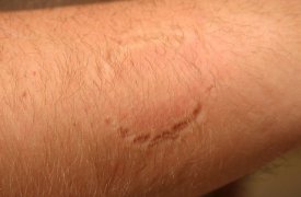 В суде рассмотрят дело в отношении заключённого, покусавшего сотрудника колонии