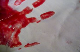 В Узловой нашли труп женщины с проломленным черепом и её задушенную 15-летнюю дочь