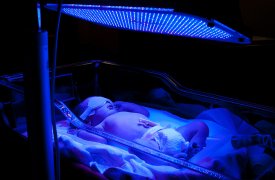 В Туле в роддоме №1 два младенца получили ожоги во время пожара