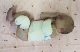 Пострадавшей в ЦРД Тулы малышке дали имя и хотят удочерить